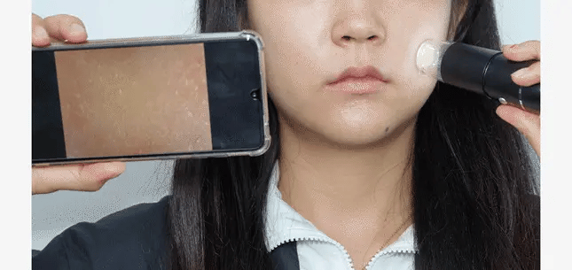 VUDE - Ultra-Low Molecular Diva Shot (Pore Care Beauty Device)