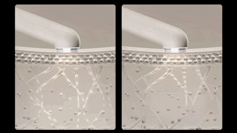 THOME The Glow Pro Ultrasound Beauty Device