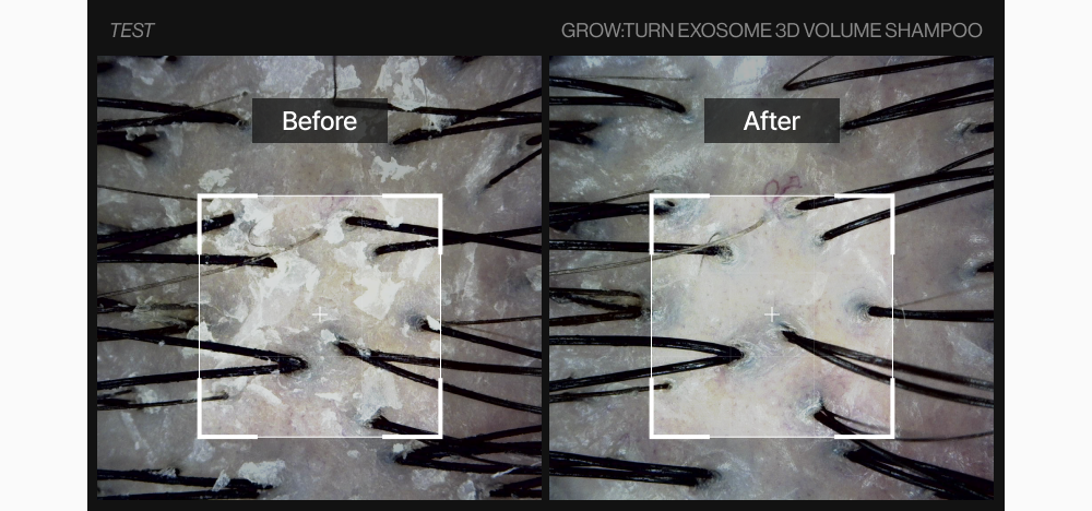lilyeve - Grow Turn Exosome 3D Volume Shampoo 500ml + 100ml + Charmander Pouch Key Chain (Pokémon Collaboration)