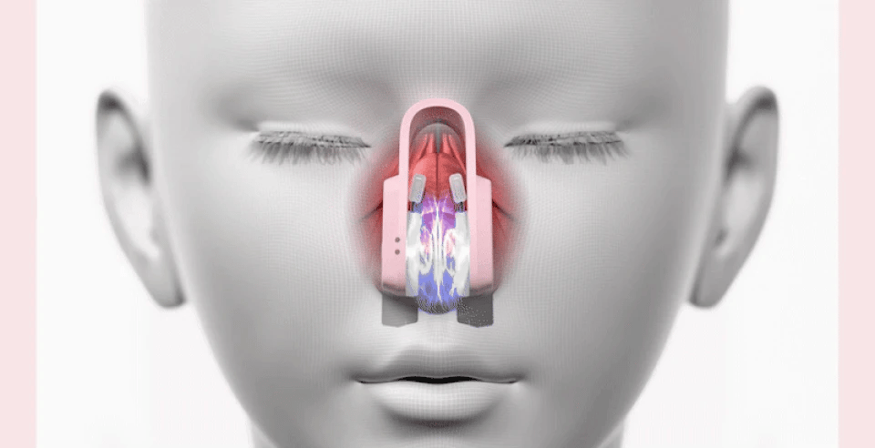 HONBODY - Nose Tune (Beauty Device)