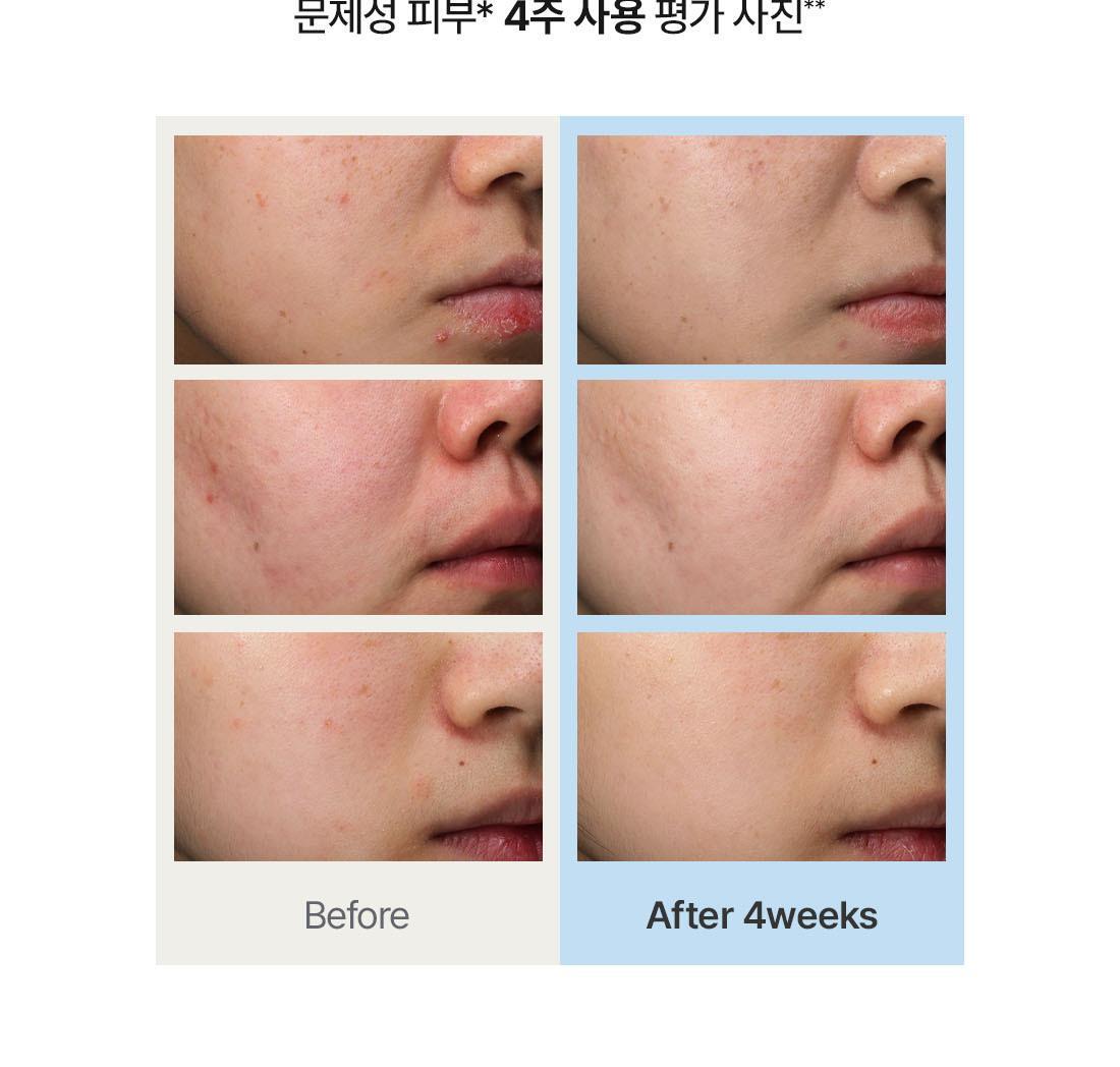 Dr. Althea - 356 Relief Cream 50ml + 10ml x2 + Tube Wringer (JANG WONYOUNG’s Pick)