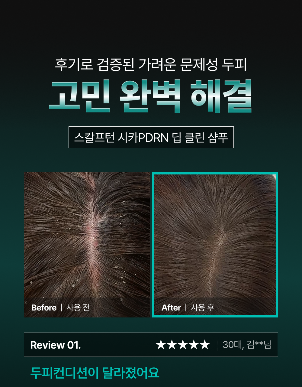 lilyeve - Scalp Turn Cica PDRN Deep Clean Shampoo 500g + 100g + Jigglypuff Pouch (Pokémon Collaboration)