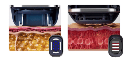 HOMEMODE - Therma Lift Beauty Device (+3 Skin Booster Ampoules)