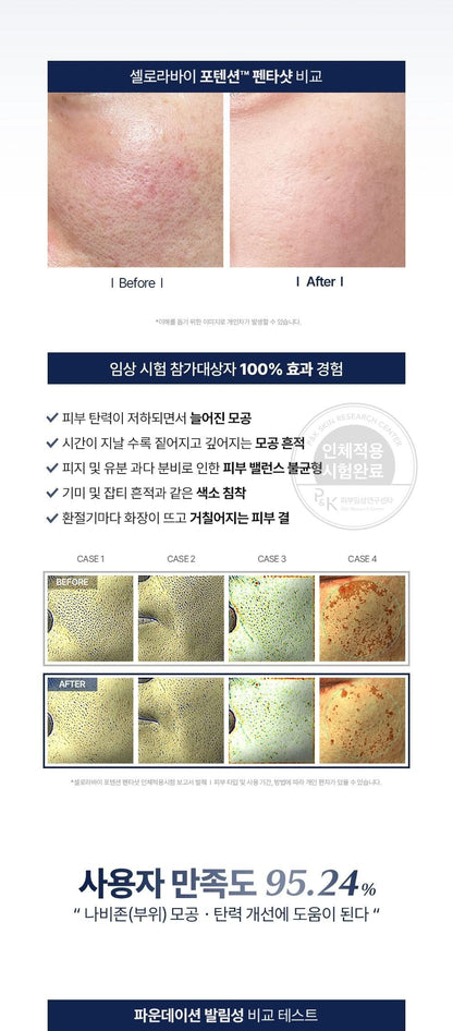 CELORA.BY - POTENSION PENTASHOT (Pore Care &amp; Skin Elasticity Enhancing Beauty Device)