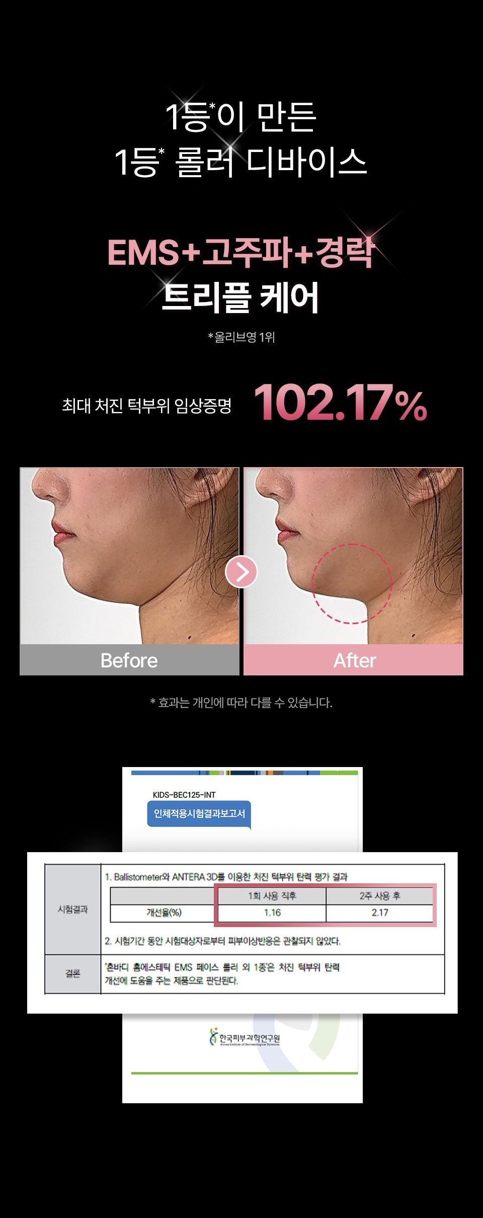 HONBODY - Big Roller Pro EMS Face &amp; Body Massager