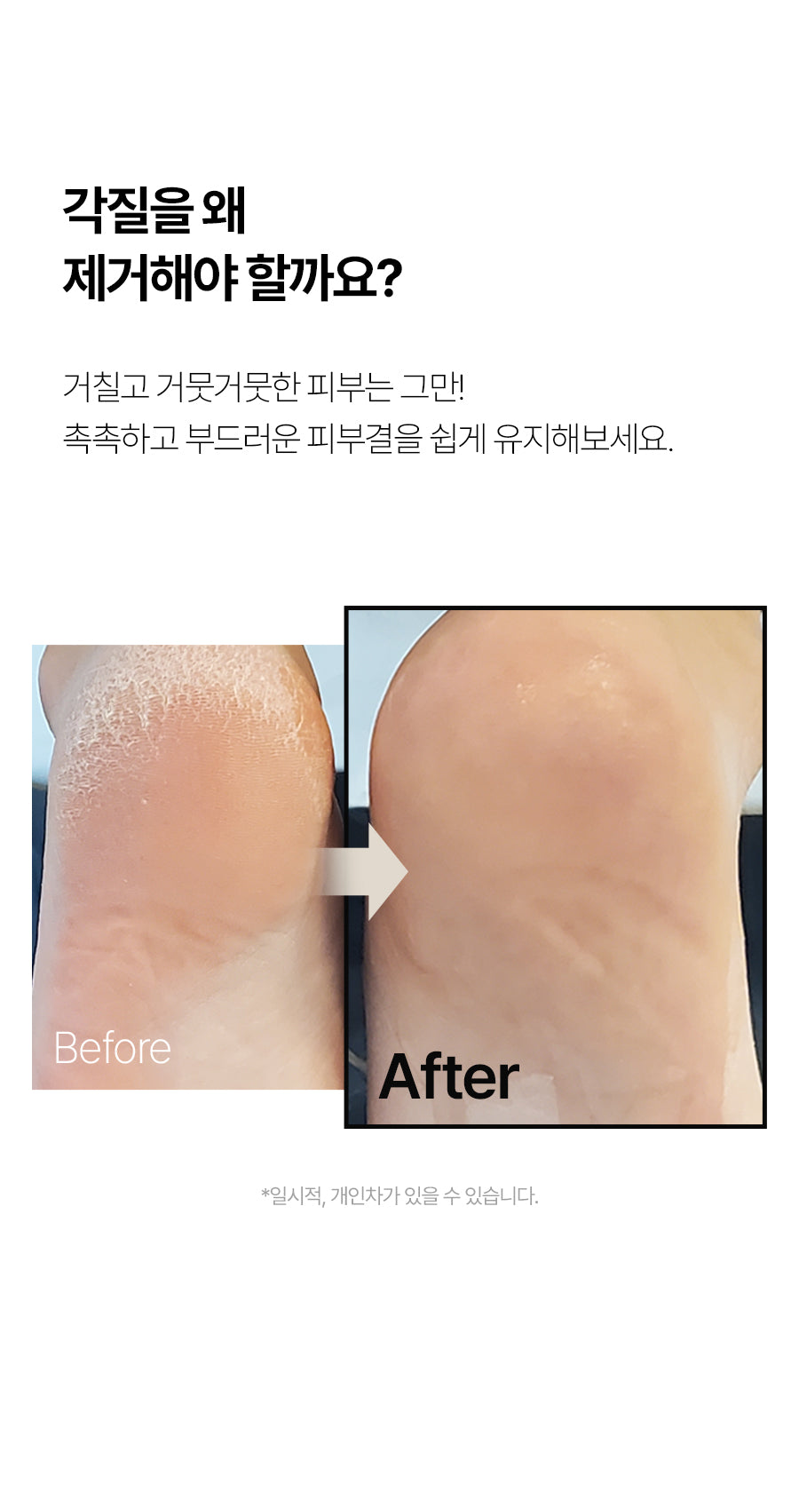 Face Factory - Diamond Head Foot Callus Remover