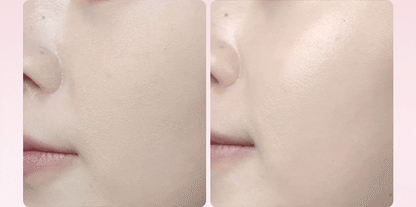 THOME - Twenty Up Beauty Device (KAZUHA Pick)