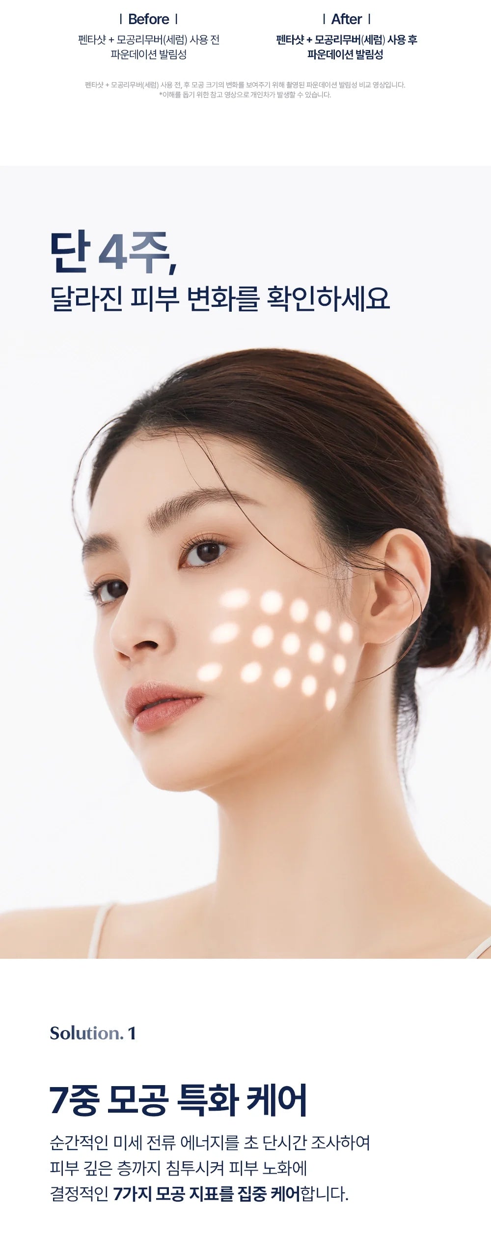 CELORA.BY - POTENSION PENTASHOT (Pore Care &amp; Skin Elasticity Enhancing Beauty Device)