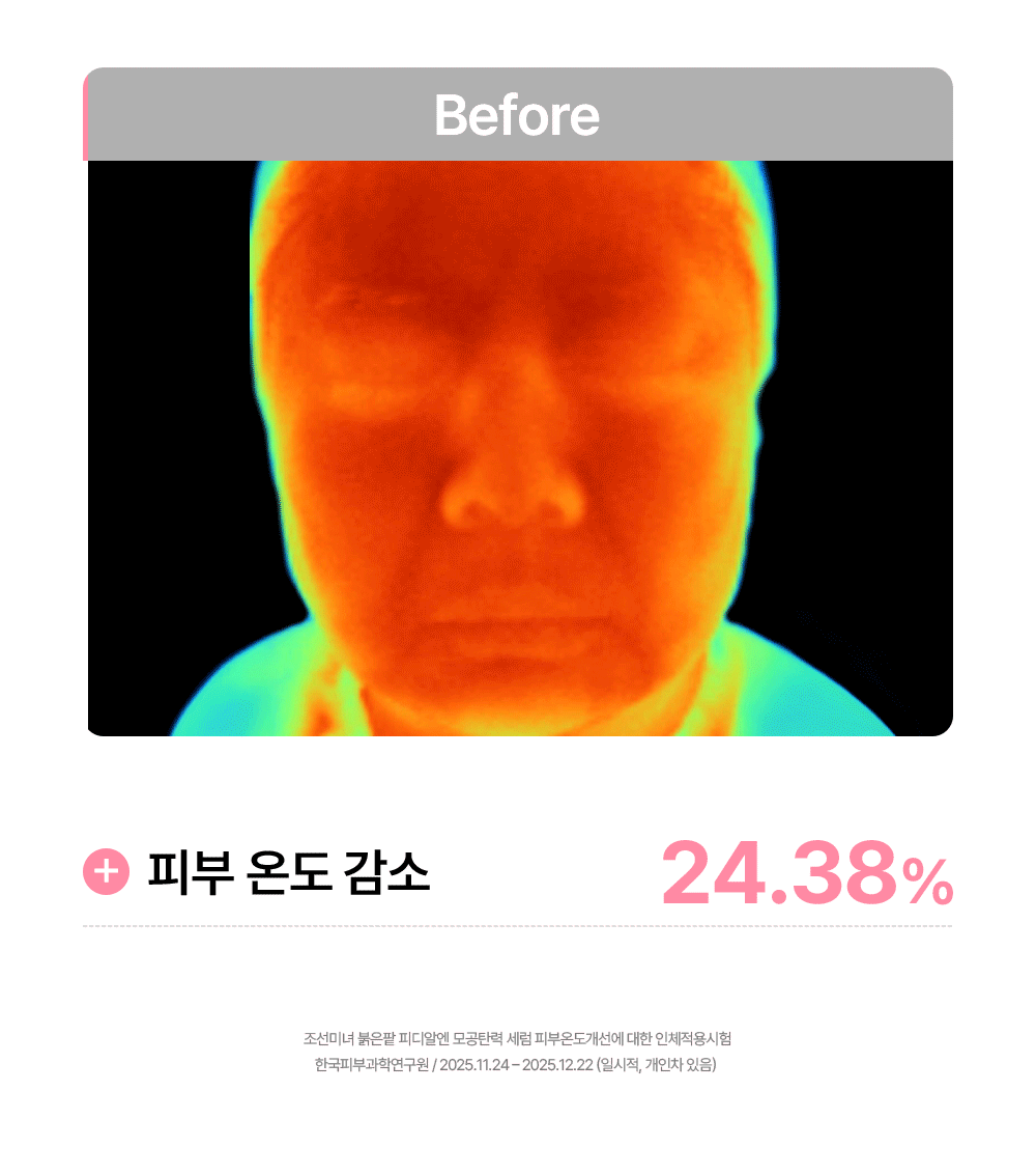 Beauty of Joseon - Red Bean PDRN Pore Tightening &amp; Firming Serum 30ml