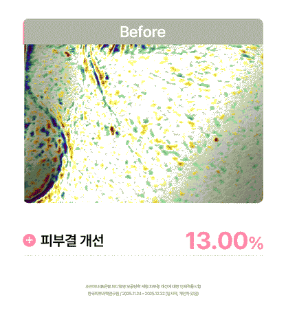 Beauty of Joseon - Red Bean PDRN Pore Tightening &amp; Firming Serum 30ml