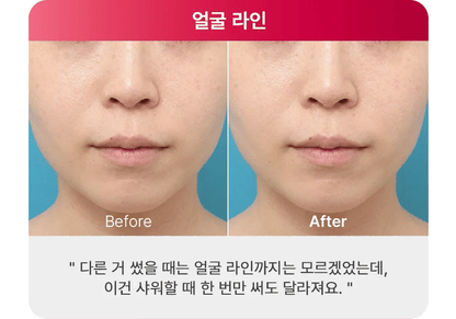 [NEW LAUNCH!] BEAUND - Lift Head Spa