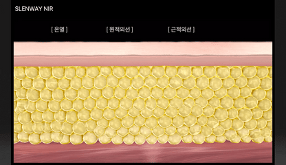 BEAUND - Slenway Beauty Device