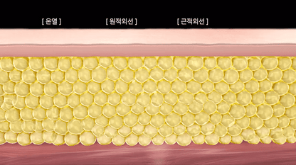 BEAUND - Slenway Beauty Device