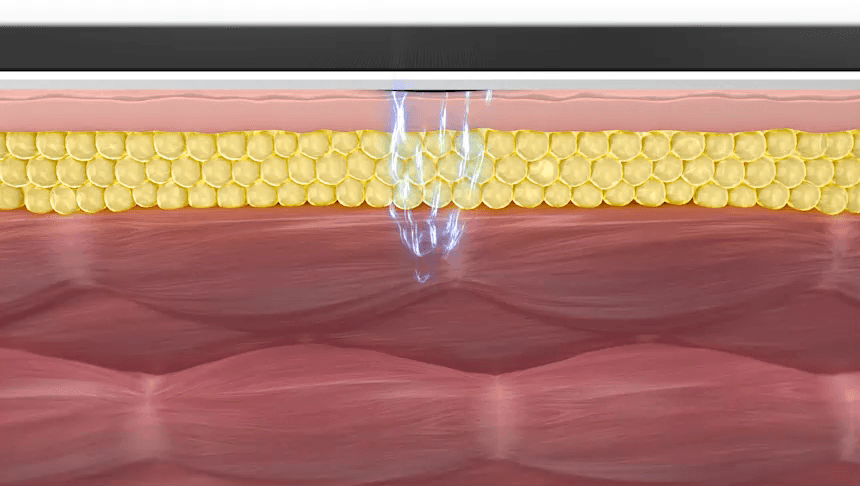 BEAUND - Slenway Beauty Device