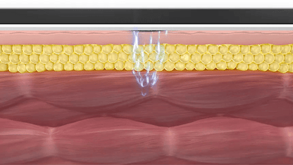 BEAUND - Slenway Beauty Device