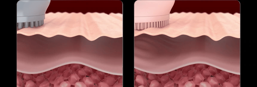 BEAUND x Esther Bunny - Ultra Wave Vibrating Facial Cleanser