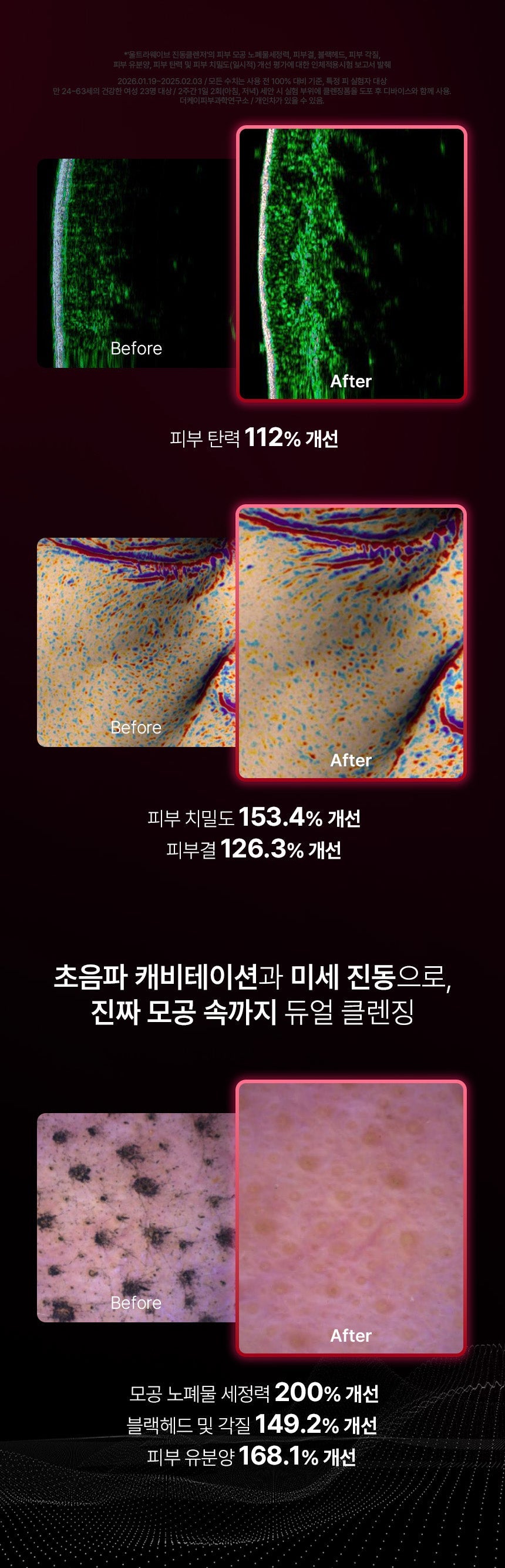 BEAUND x Esther Bunny - Ultra Wave Vibrating Facial Cleanser