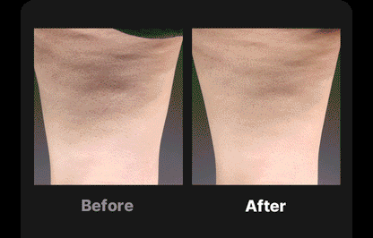 BEAUND - Leg Thin Beauty Device