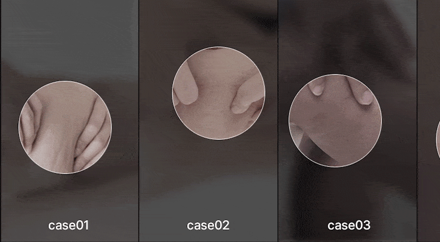 BEAUND - Leg Thin Beauty Device