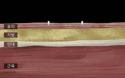 BEAUND - Leg Thin Beauty Device