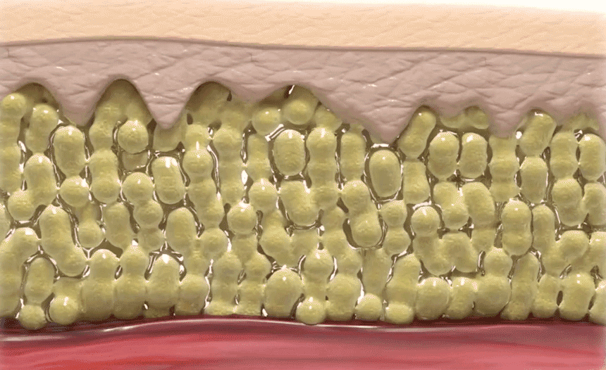 BEAUND - Leg Thin Beauty Device