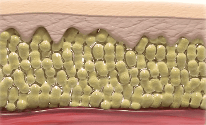 BEAUND - Leg Thin Beauty Device