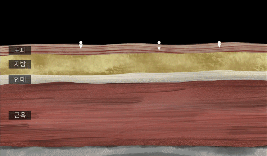 BEAUND - Leg Thin Beauty Device