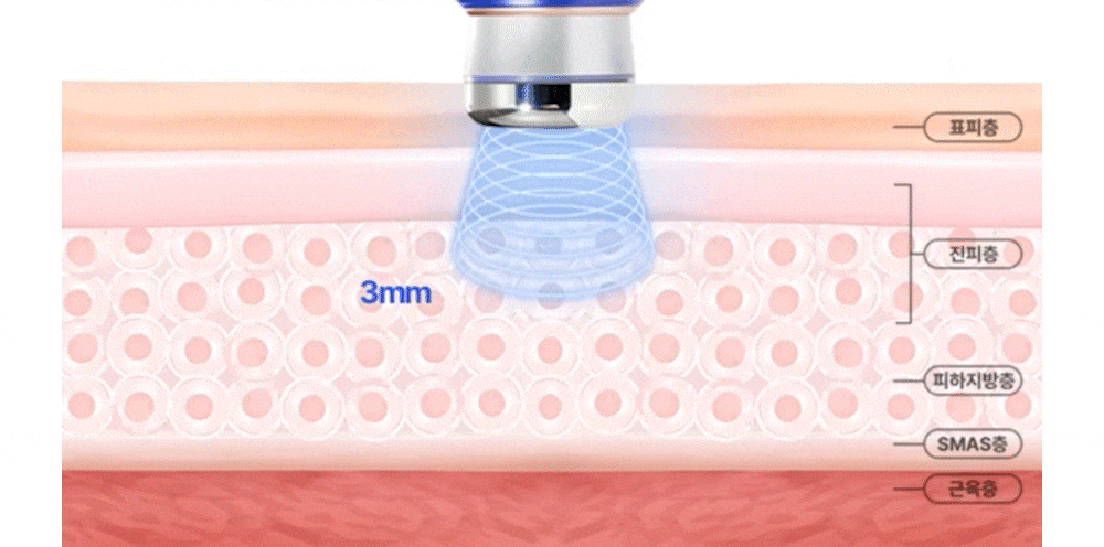 OLLIVIA - The Orlier S1 Beauty Device (Facial Contour &amp; Lifting Care)