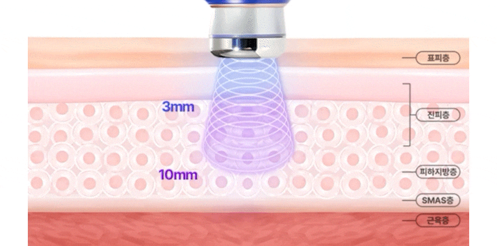 OLLIVIA - The Orlier S1 Beauty Device (Facial Contour &amp; Lifting Care)