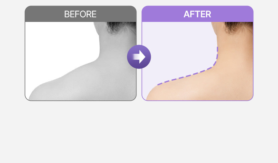 [BALANCE FIT] - Neck &amp; Shoulder Massager