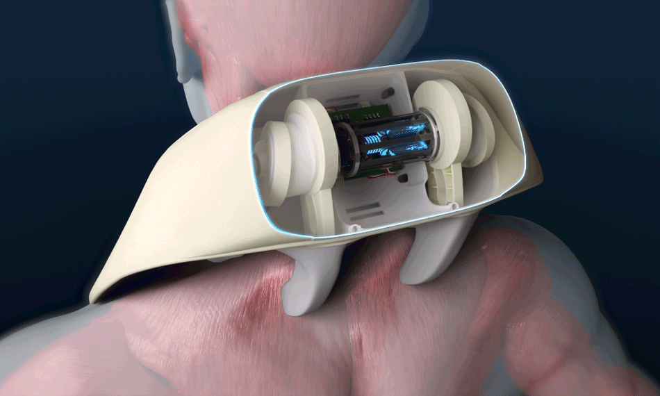 [SPAR] - Portable Neck &amp; Shoulder Massager PRO