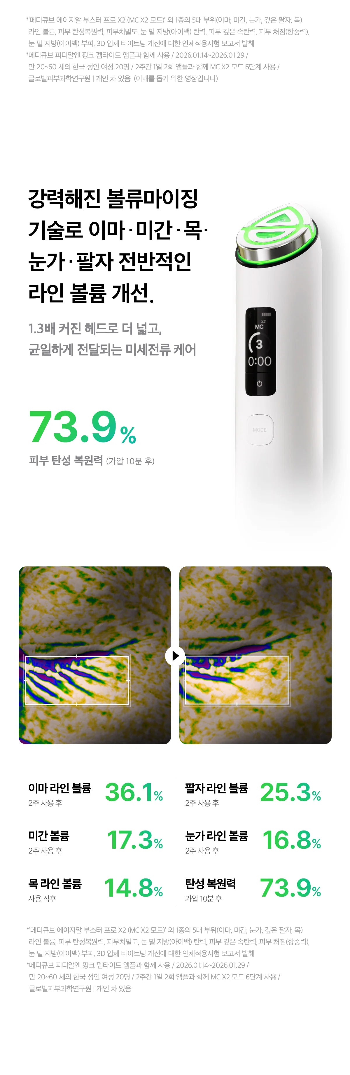 Medicube - AGE-R Booster Pro X2 ZO&amp;FRIENDS Edition (Beauty Device)