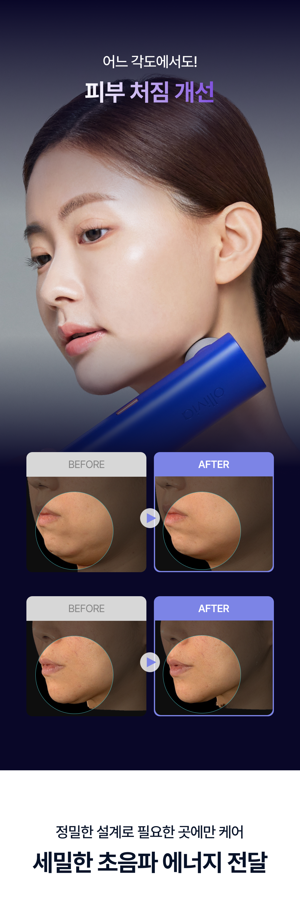 OLLIVIA - The Orlier S1 Beauty Device (Facial Contour &amp; Lifting Care)