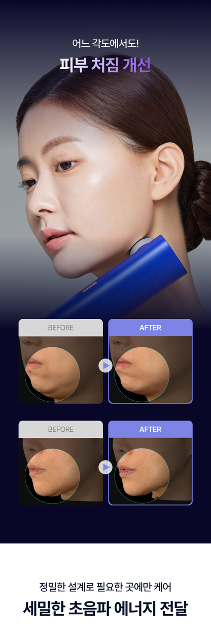 OLLIVIA - The Orlier S1 Beauty Device (Facial Contour &amp; Lifting Care)