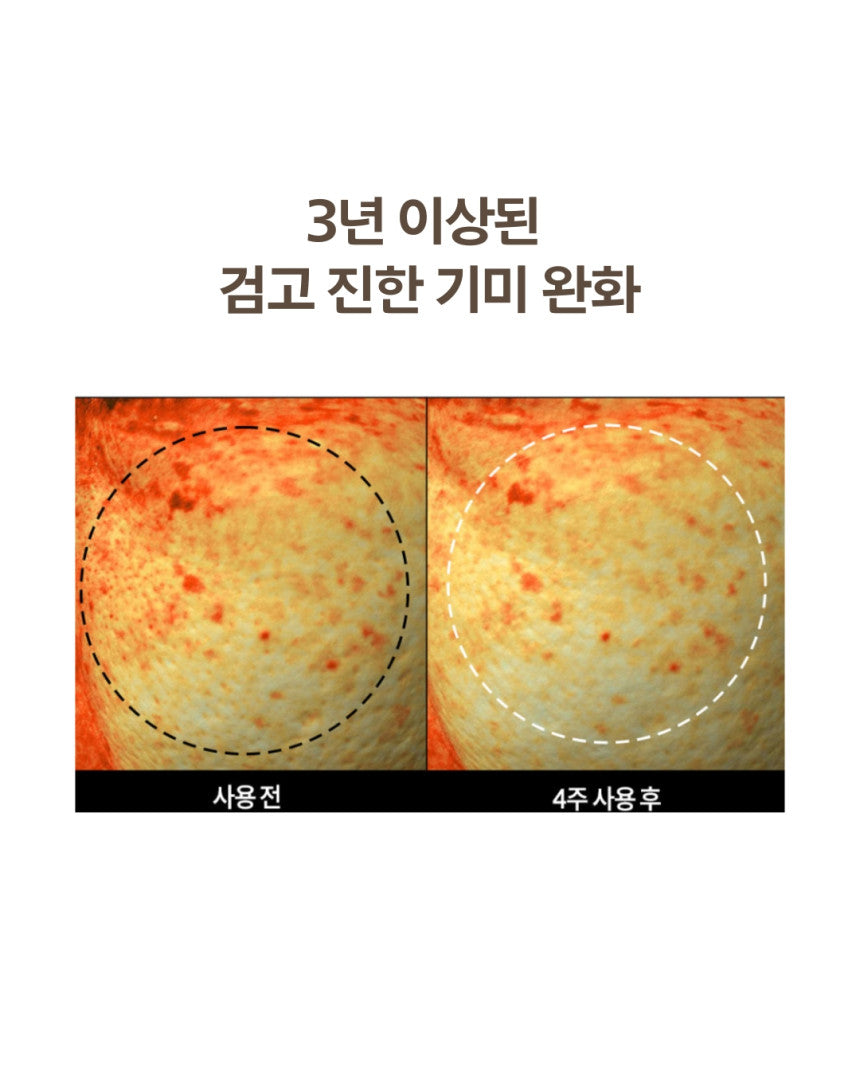 DOMINAS - Dark Spot &amp; Melasma Cream (Tranexamic Acid) [K-Pharmacy Item]
