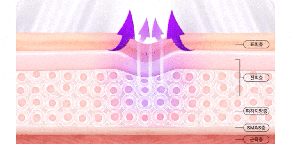 OLLIVIA - The Orlier S1 Beauty Device (Facial Contour &amp; Lifting Care)