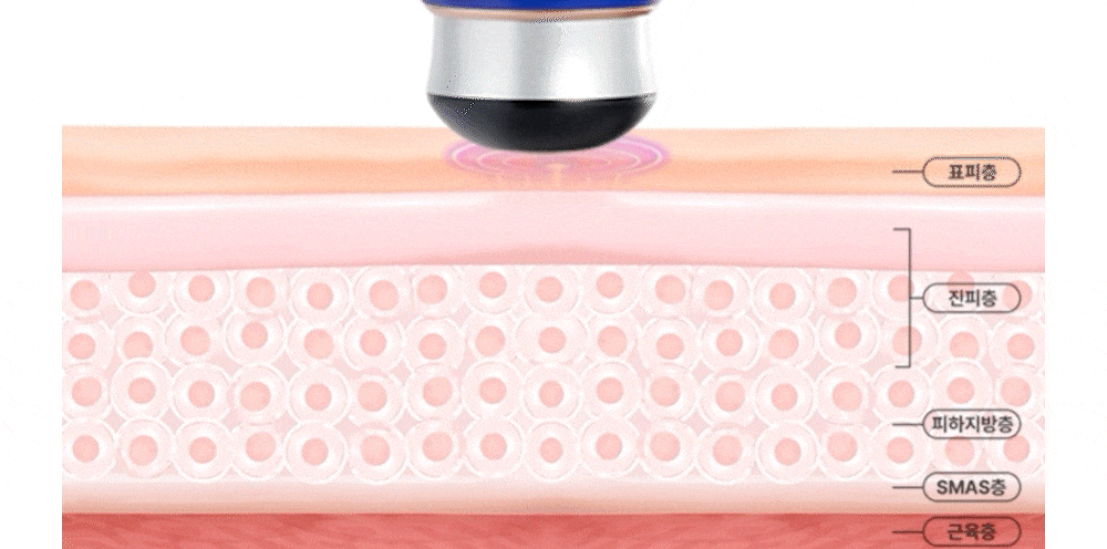 OLLIVIA - The Orlier S1 Beauty Device (Facial Contour &amp; Lifting Care)