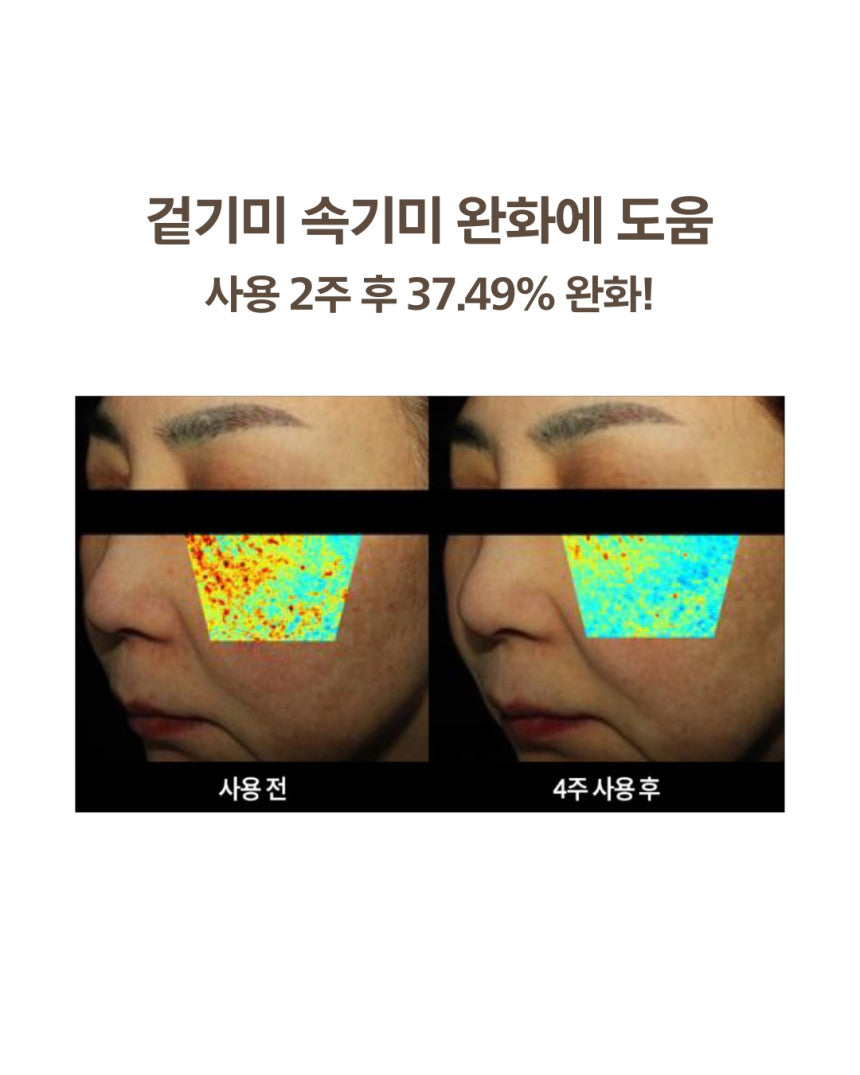 DOMINAS - Dark Spot &amp; Melasma Cream (Tranexamic Acid) [K-Pharmacy Item]