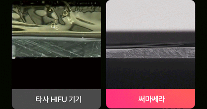 THERMATHERA - Unlimited-Shot HIFU Beauty Device [New Launch!]