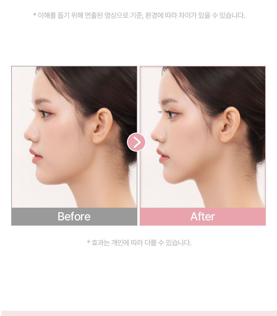 HONBODY - Big Roller Pro EMS Face &amp; Body Massager