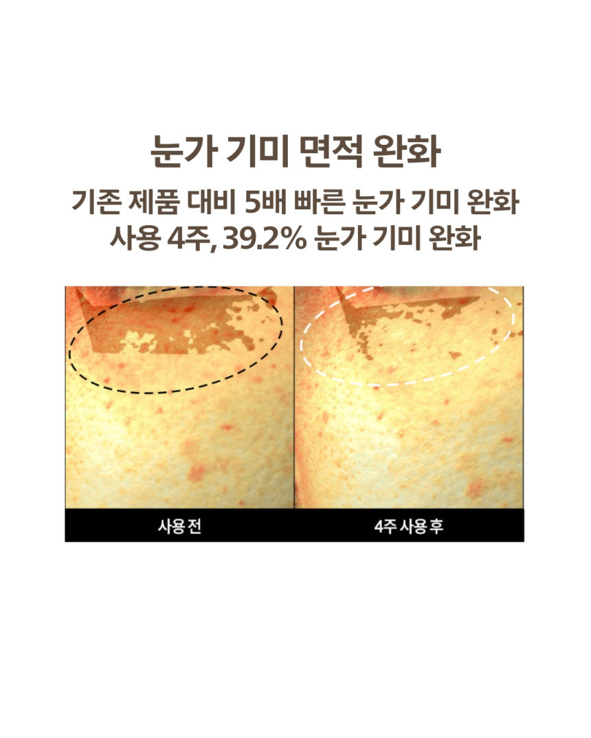 DOMINAS - Dark Spot &amp; Melasma Cream (Tranexamic Acid) [K-Pharmacy Item]