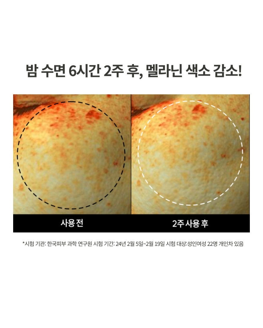 DOMINAS - Dark Spot &amp; Melasma Cream (Tranexamic Acid) [K-Pharmacy Item]