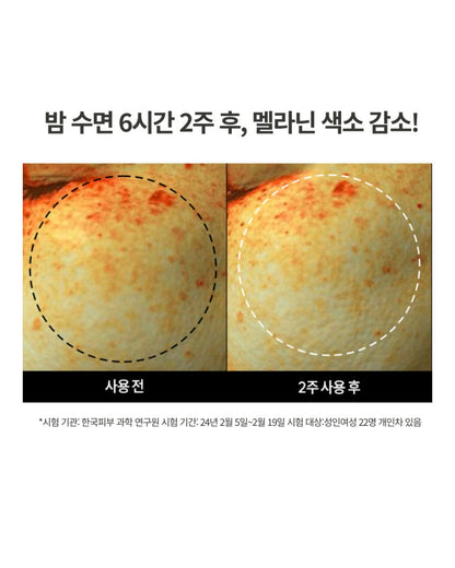 DOMINAS - Dark Spot &amp; Melasma Cream (Tranexamic Acid) [K-Pharmacy Item]