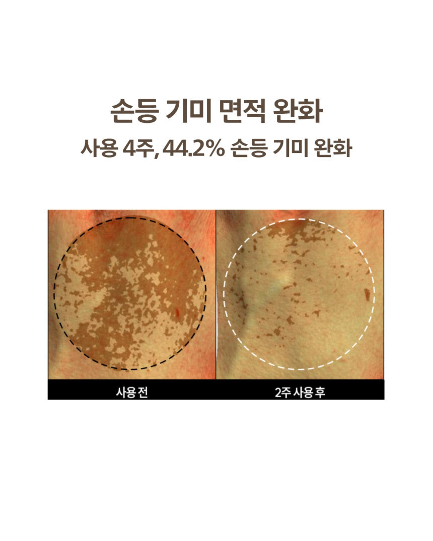DOMINAS - Dark Spot &amp; Melasma Cream (Tranexamic Acid) [K-Pharmacy Item]
