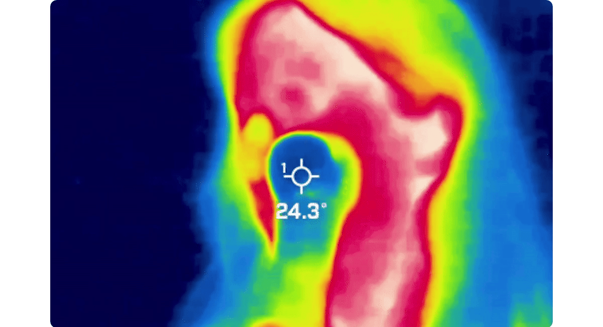 [Glow.M] Cryo Sonic Pro (Cooling, Firming &amp; Radiance Care)