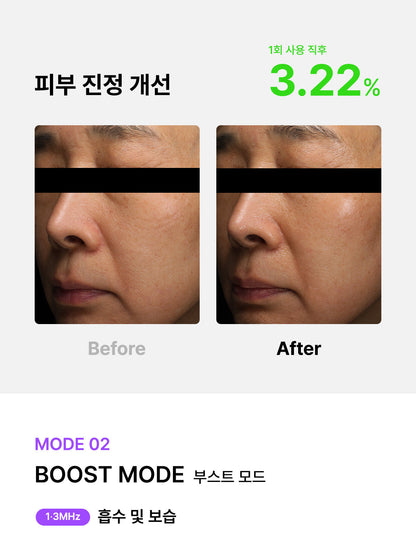 [Glow.M] Cryo Sonic Pro (Cooling, Firming &amp; Radiance Care)