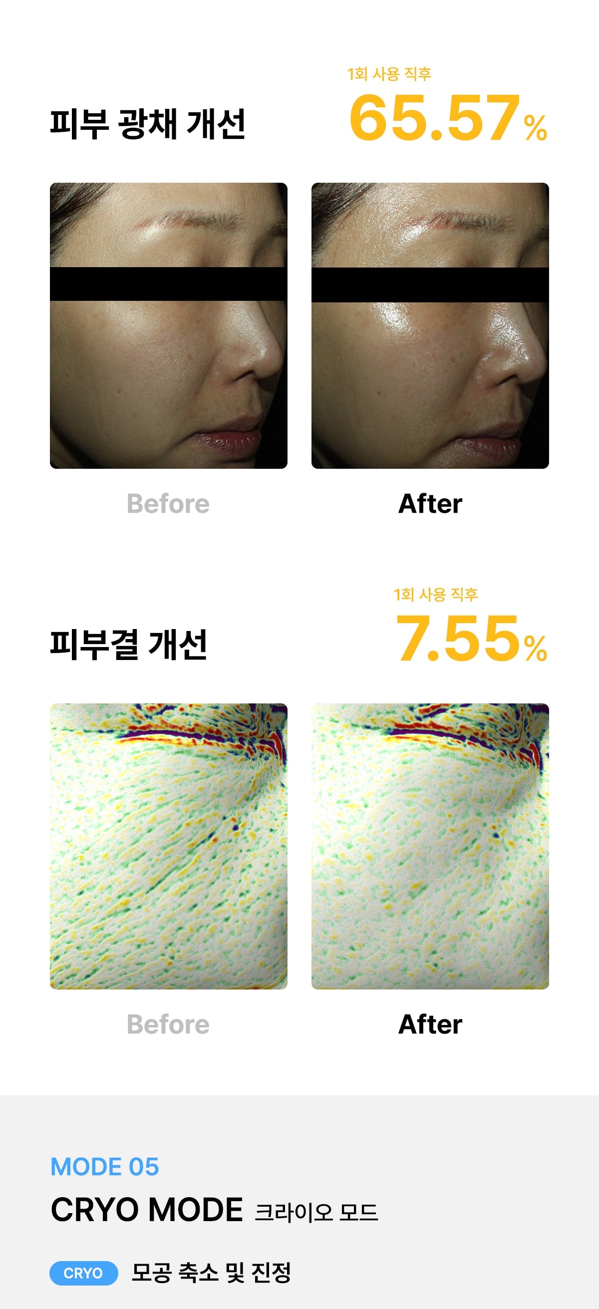 [Glow.M] Cryo Sonic Pro (Cooling, Firming &amp; Radiance Care)
