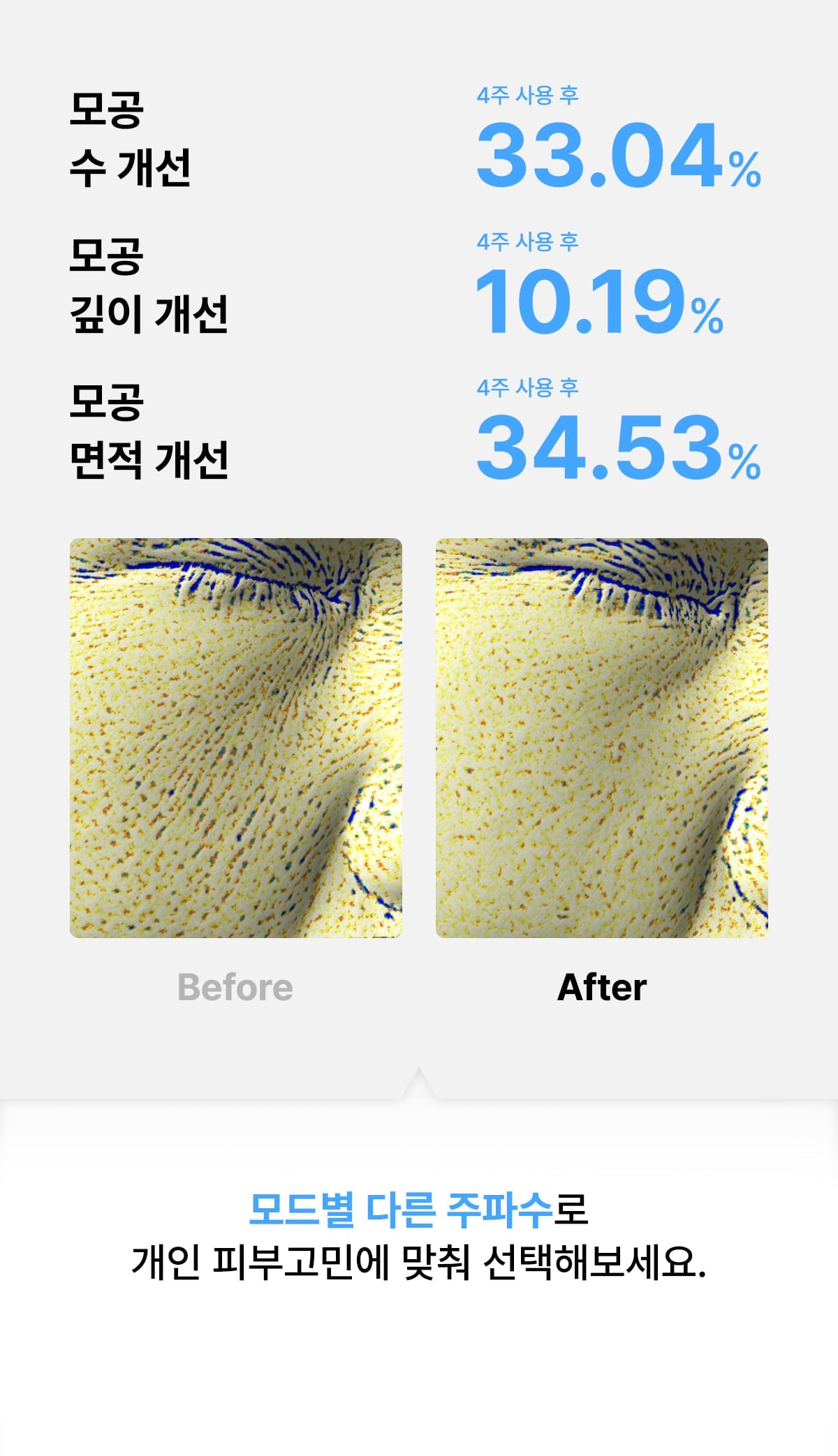 [Glow.M] Cryo Sonic Pro (Cooling, Firming &amp; Radiance Care)