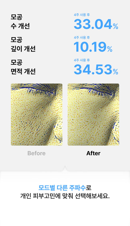 [Glow.M] Cryo Sonic Pro (Cooling, Firming &amp; Radiance Care)