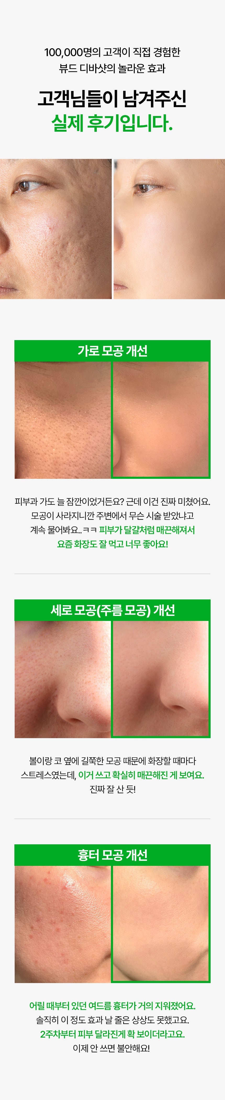 VUDE - Ultra-Low Molecular Diva Shot (Pore Care Beauty Device)